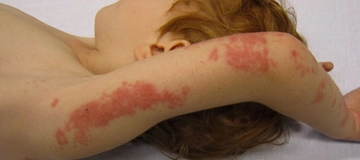 Zona İçin Şifalı Bitkiler Kullanımı ve Faydaları Nelerdir? Zona İçin Şifalı Bitkiler Kullanımı ve Faydaları Nelerdir?